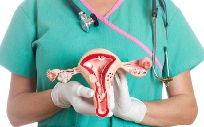   Setiap Tahun 18.000 Lebih Perempuan Indonesia Meninggal akibat Kanker Serviks