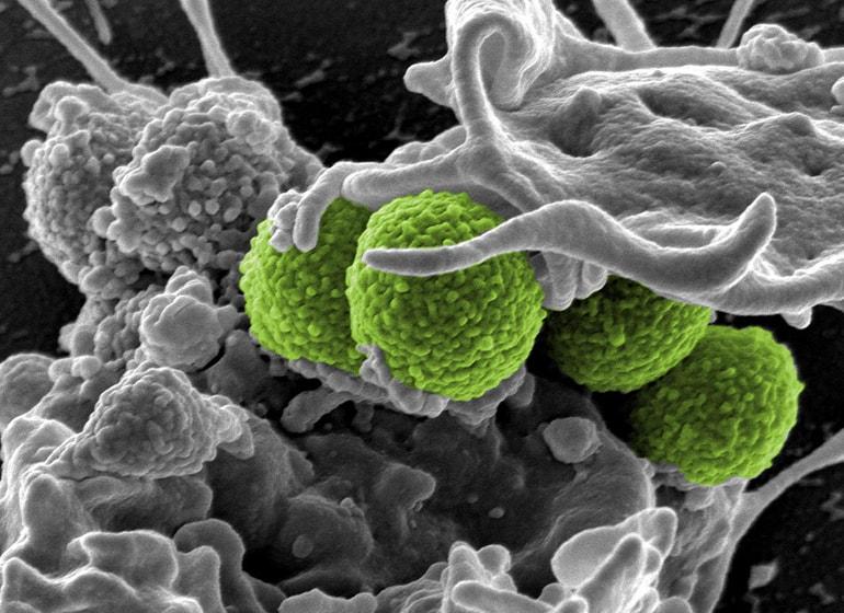  Bakteri Bisa Kebal terhadap Antibiotik? Ini Penjelasannya