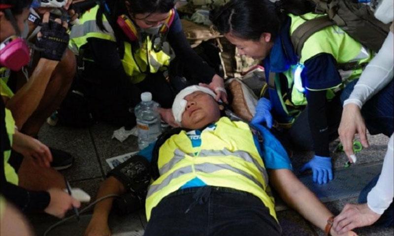  Wartawati Indonesia Tertembak Peluru Karet di Hong Kong Kondisinya Stabil