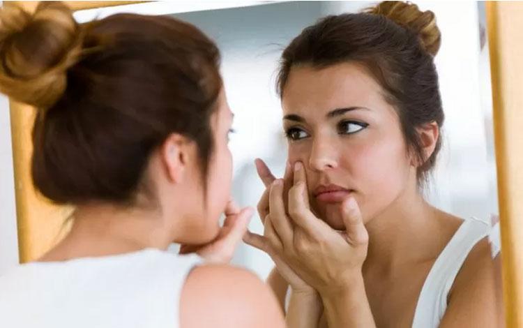  Posisi Jerawat Bisa Jelaskan Kondisi Tubuh