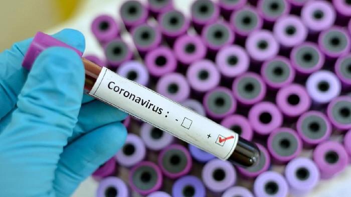  Waspadai Virus Corona yang Telah Menelan 80 Korban