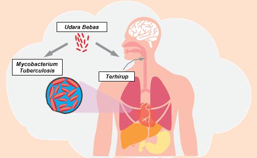  Bakteri Purba Tuberculosis, sudah Bunuh Manusia Sejak Jutaan Tahun Lalu