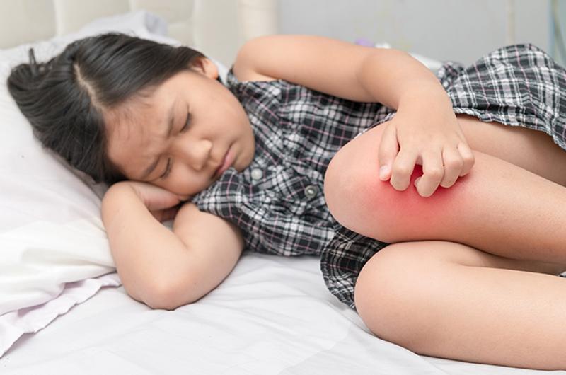  Hati-Hati, Radang Sendi Anak Lebih dari 6 Minggu Bisa Jadi Gejala Autoimun